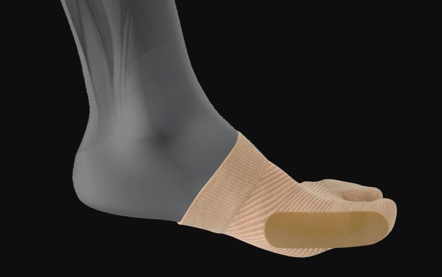 OS1 HV3 Bunion Bracing Sleeve OS1-1334